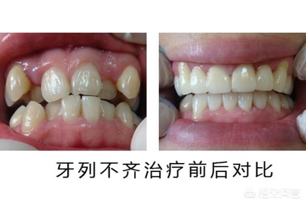 果洛最新24小时牙医在线咨询方法分析(最方便真实的果洛有没有24小时牙医方法)