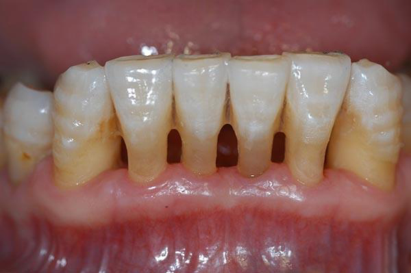 果洛最新24小时牙医在线咨询方法分析(最方便真实的果洛有没有24小时牙医方法)